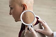 Skin checks and early skin cancer detection - Providence Medical