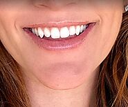 Know more about best teeth whitening company