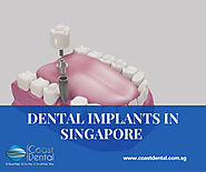 Dental implant in Singapore