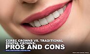 CEREC Crowns vs. Traditional Dental Crowns: Pros and Cons | Lambton Family Dental