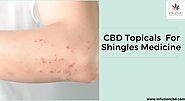 How CBD Topicals Used for Shingles Medicine?