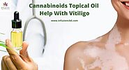 How Does Cannabinoids Topical Oil Help With Vitiligo?