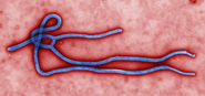 The Ebola epidemic http://www.cdc.gov/vhf/ebola/outbreaks/2014-west-africa/