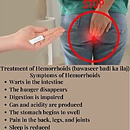 Treatment of Hemorrhoids (Bawaseer Baqi Ka Ilaj) with Indigenous Herbs. Get rid of bloody and bad hemorrhoids. Elimin...