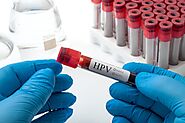 HPV-LBC Screening Test – Blog