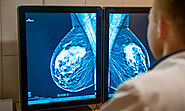 Best Mammography Centres in Gurgaon - MDRC India