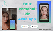 Skin Acne App – Your personal Skin Acne Advisor.