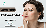 OPU Acne App For Android - OPU Labs
