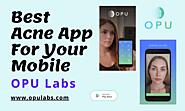 Best Acne App For Your Mobile - OPU Labs