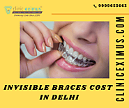How Much Do Invisible Braces Cost in Delhi?