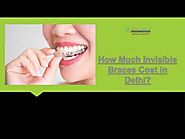 How Much Invisible Braces Cost in Delhi