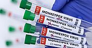 Canada issues travel notice as monkeypox continues to spread around the world