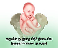 Baby Breech Position: கருவில் குழந்தை பிரீச் நிலையில் இருந்தால் என்ன நடக்கும்?