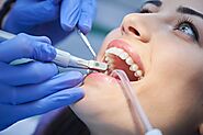 Is It Safe to Visit Your Dentist During COVID? - Savanna Dental