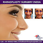 Rhinoplasty Surgery in Delhi | Nose Reshaping Cost - Dr Ajaya Kashyap