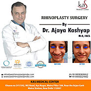 Rhinoplasty or Nose Job Surgery at Best Cost in Delhi