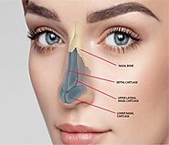 Revision Rhinoplasty | Facial Plastic Surgery Clinic in Delhi