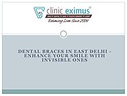 PPT - Dental Braces in East Delhi PowerPoint Presentation, free download - ID:10384411