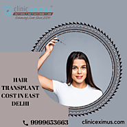 Get Complete Information About Hair Transplant Cost in Delhi