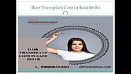 Hair Transplant Cost in East Delhi