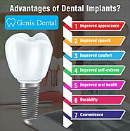 What Are Dental Implants? - Dr. Oleg Genis, DMD