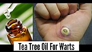 Tea Tree Oil for Warts: How to Use Tea Tree Oil for Wart Removal
