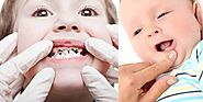 Baby Bottle Tooth Decay: Causes, Signs, And Prevention