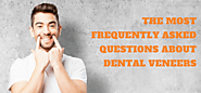 The Most Frequently Asked Questions About Dental Veneers