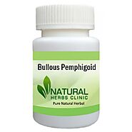 Natural Remedies Bullous Pemphigoid