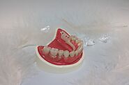 Want a Perfect Denture for your Patients? Help Your Denture Dental Lab with 3 Things