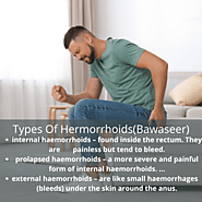 A cure for Hemorrhoids(Bawaseer ka ilaj)