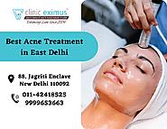 Are You Looking For The Best Acne Treatment in East Delhi? – Clinic Eximus