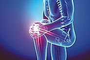 Orthopedic Hospital in Chennai | Best Orthopedic Specialist in Chennai | Best Orthopedic Doctors