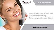 A Guide to Incognito Hidden Braces and the Benefits of Using a Temporary Anchorage Device (TAD) Before and After