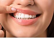 Website at https://5ea492f3e715d.site123.me/blog/7-ways-to-getting-back-your-gums-healthy/-content