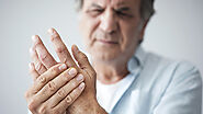 Effective Natural Remedies for Treating Dupuytren’s Contracture