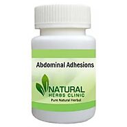 Herbal Treatment for Abdominal Adhesions - Natural Herbs Clinic
