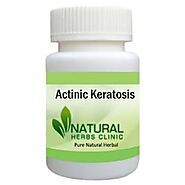 Herbal Treatment for Actinic Keratosis - Natural Herbs Clinic