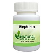 Herbal Treatment for Blepharitis | Natural Remedies | Natural Herbs Clinic