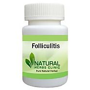 Herbal Treatment for Folliculitis | Natural Remedies | Natural Herbs Clinic