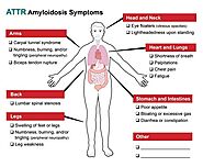 hATTR Amyloidosis Symptoms