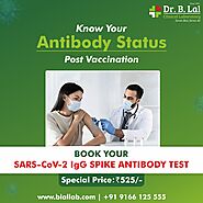 Book SARS-CoV-2 IgG SPIKE ANTIBODY TEST
