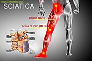 A very common condition that we are seeing more and more of is of sciatic pain.