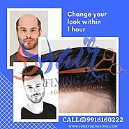 HAIR FIXING ZONE Offers instant solution for Hair loss