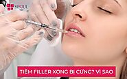 Vì sao tiêm filler bị cứng? Cách xử lý hiệu quả - Seoul Center