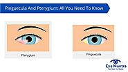 Pinguecula And Pterygium: All You Need To Know | Eyemantra Hospital