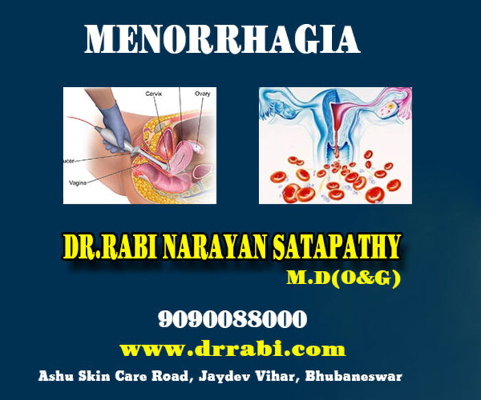 Infertility clinic in Bhubaneswar - Gynecologist Surgeon for Myomectomy Doctor in Bhubaneswar