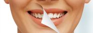 How a Dental Practice Can Easily Improve the Look of Your Smile?