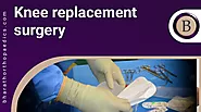 Knee Replacement Surgery in Chennai