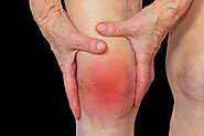 ​Arthritis – A disheartening knee problem in India - UltraCare Pro